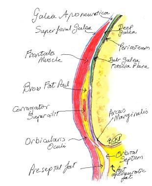 Sagittal section of the forehead and brow illustra