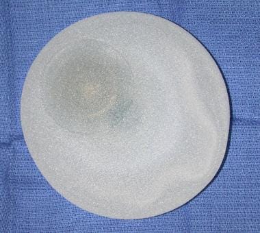 Expander-implant breast reconstruction. Textured s