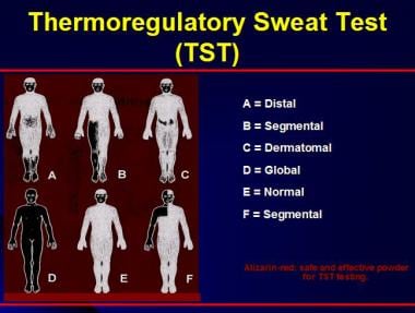Thermoregulatory sweat testing (TST). 
