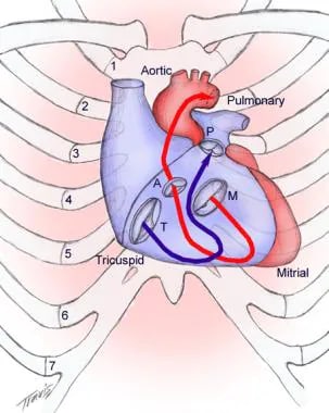 Surface anatomy of the heart. A = aortic valve; M 