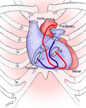 Heart chamber anatomy PI - UpToDate