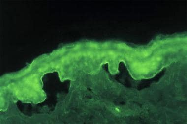 Indirect immunofluorescence study performed on sal