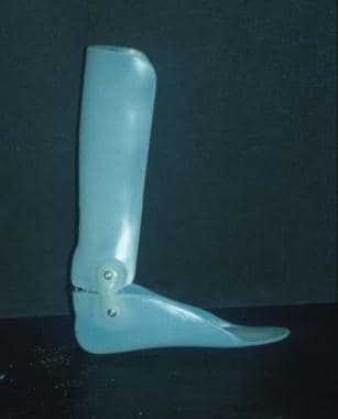 Articulated molded ankle-foot orthosis (AFO). This