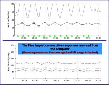 Heart rate response to deep breathing (HRDB). 