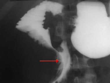 A 24-year-old man with blunt abdominal trauma and 