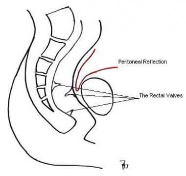 Basic anatomy of rectum. 