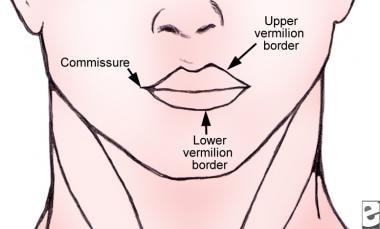 Upper Lip Anatomy