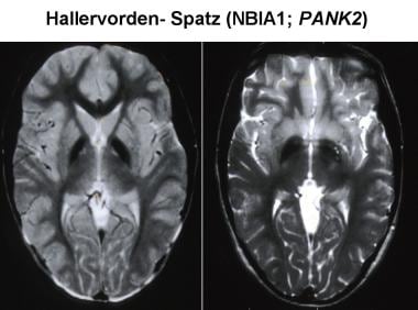 Magnetic resonance imaging (MRI) has increased the