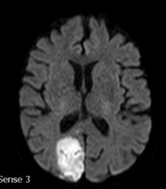 Brain magnetic resonance imaging (MRI) scan demons
