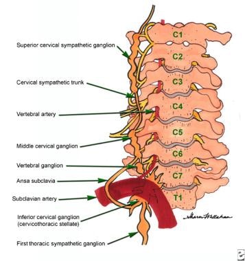 Chronic Pain Syndrome Treatment & Management: Approach Considerations,  Physical Therapy, Occupational and Recreational Therapy