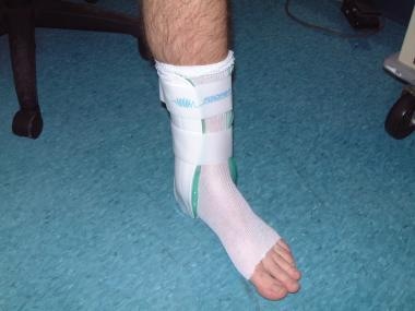 Aircast providing rigid lateral ankle support. 