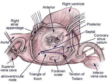 The tricuspid valve (TV) as viewed from the right 