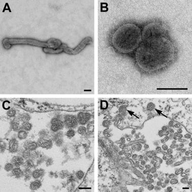 Electron microscopic images of novel Thogotovirus 