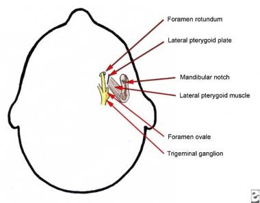 Anatomy of the fifth cranial nerve (trigeminal) ga