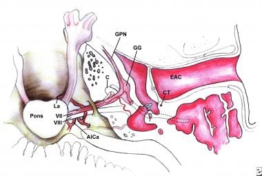 Superior view of the intracranial, meatal, labyrin