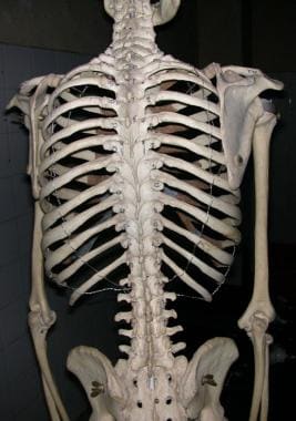 View of human skeleton from behind, showing rib ca