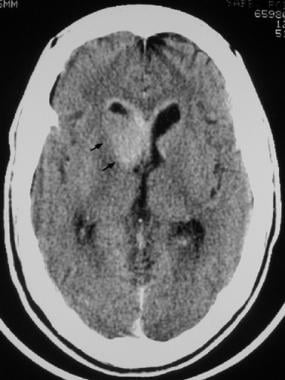 Intravenously contrast-enhanced CT scan of the hea