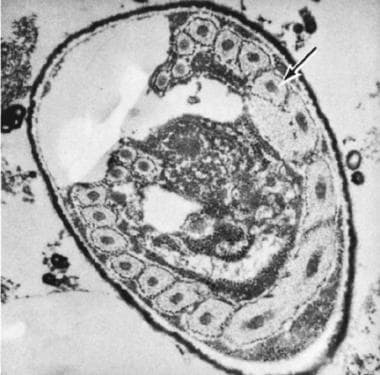 Electron micrograph (X30,000) of Nosema connori in