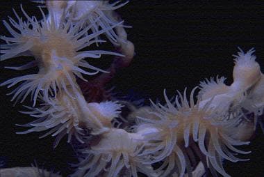 Cnidaria and jellyfish envenomations. Close-up pho