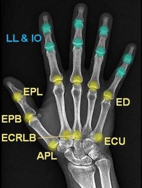 Extensor Tendons Hand Anatomy - Anatomy Reading Source