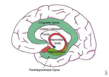 medial temporal lobe epilepsy