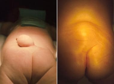 These 2 photographs depict the lumbar regions on 2