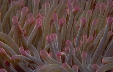 Cnidaria and jellyfish envenomations. Close-up pho