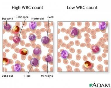 band neutrophil pathology