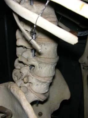 Lumbar spine, as seen from side. 