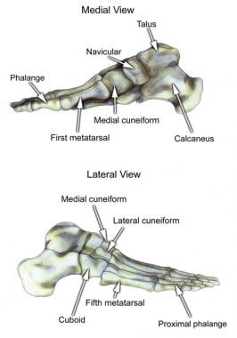 Bones of the foot, medial and lateral views. 
