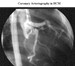 Imaging in Hypertrophic Cardiomyopathy