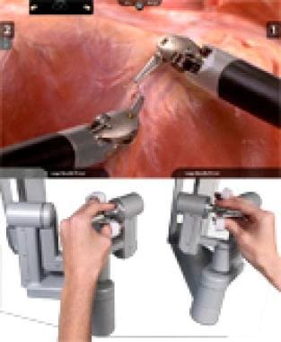 The daVinci hand control. ©2011 Intuitive Surgical