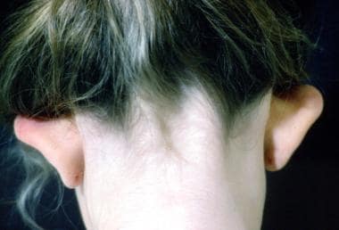 a) Preoperative findings. A 41-year-old woman with an elastic, hard