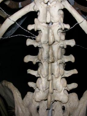 Lumbar spine, as seen from behind. 