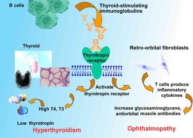 Statins for Graves' orbitopathy (STAGO): a phase 2, open-label, adaptive,  single centre, randomised clinical trial - The Lancet Diabetes &  Endocrinology