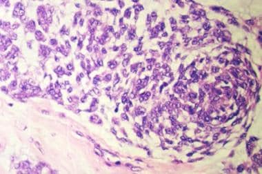 Oval- to spindle-shaped cells forming a fascicle (