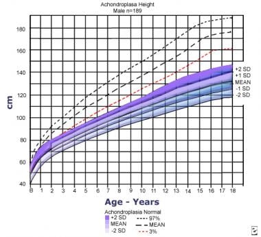 achondroplasia vs normal