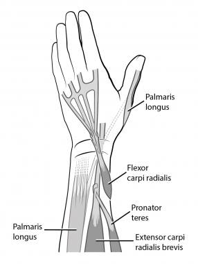 Radial Nerve Palsy Tendon Transfer