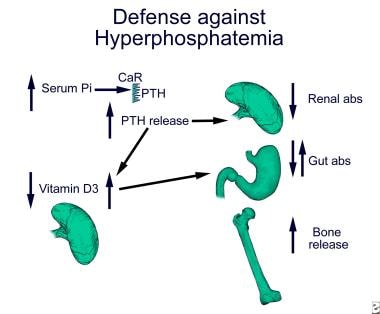 What Is The Role Of Parathyroid Hormone Pth And Vitamin D In Hyperphosphatemia