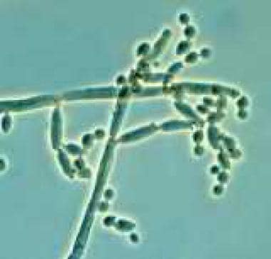 Cladosporium (Hormodendrum). 