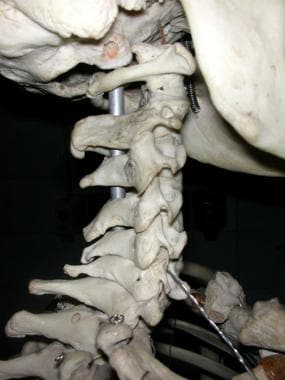 颈椎，从侧面看，显示解剖学