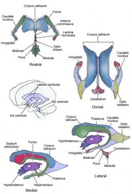 Ventricles and the borders of major adjacent anato