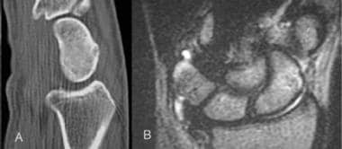 Images obtained in a patient who fell on an outstr