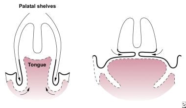 Formation of the secondary palate. 