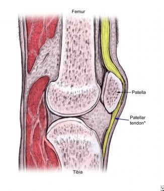 The proximal patellar tendon is most commonly affe