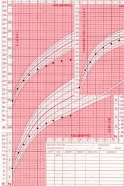 Growth Hormone Deficiency Growth Chart