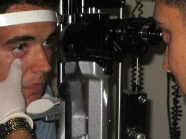 Positioning at the slit lamp. 