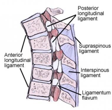 This lateral projection of the lumbar spine demons