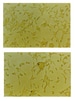 Cell Biology of Head and Neck Squamous Cell Carcinoma