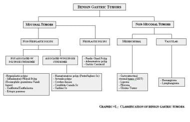 Classification of benign gastric tumors. 